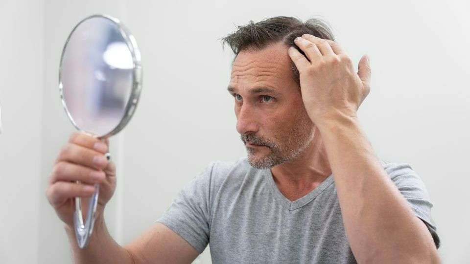 Male Hair Loss